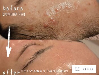 ボウ 名古屋店(VOEUX)