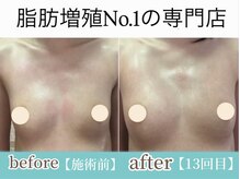 サラエクセレント 銀座/くっきり谷間にバストアップ！