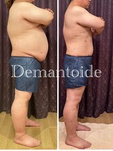デマントイド(Demantoide&Co)