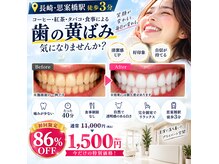 ホワイトニングショップ 長崎店