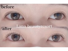 ラナビューティリゾート(Lana Beauty resort)/アップラッシュリフト