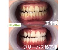 ルブラン 奈良店(Le Blanc)/通い放題は