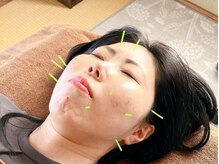 ひろ中鍼灸マッサージ院