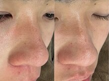 ケアナ 梅田店(CareNa)/メンズの清潔感ここにあり