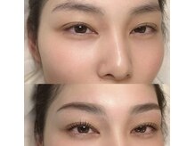 ヴィジョン(VISION)の雰囲気（似合わせ眉毛は骨格に合わせて計測していきます！垢抜け効果抜群）