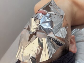 アズリー ルナ(AzRee Luna)の写真/肌質改善はマーメイドセルトリートメントから！理想のハリツヤを実現し自信を持てる素肌に♪毛穴洗浄付き◎