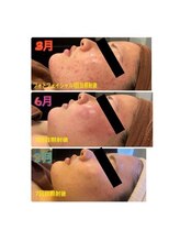 サロン ド フェイス モアナ(Salon de Faith Moana)/フォト光フェイシャル