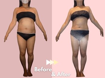 キレイサローネ 銀座店(KIREI SALONE)/☆ビフォーアフターのご紹介☆