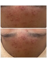 CPサロン フェリーチェ/20代の悩みを解決