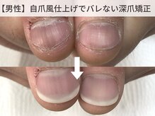 エルナ/男性の方もご来店頂いています！