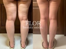 フロル(FLOR)の雰囲気（OPUSで華奢な身体に！）