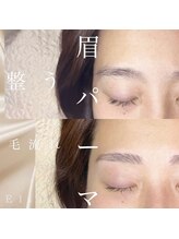 エリーゼ(Elise)/