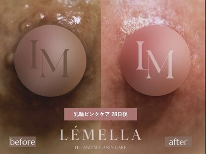 クラルテ(Clarte)の写真