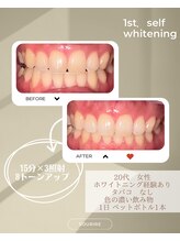 スリール(sourire)/