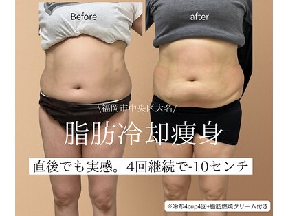 ウナ 福岡店(UNA)の写真