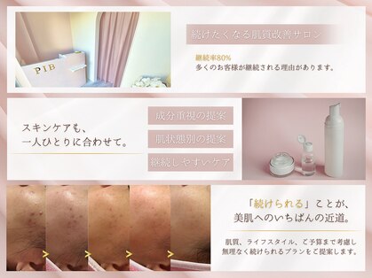 ピブ(pib.)の写真