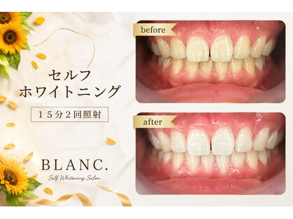 ブラン(BLANC.)の写真