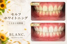 ブラン(BLANC.)
