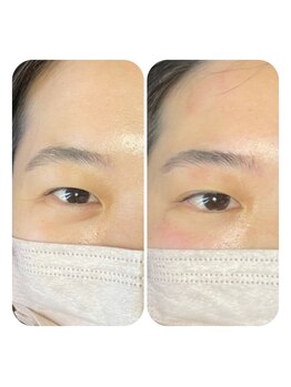 チル サロン(chill salon)/アイストレッチ