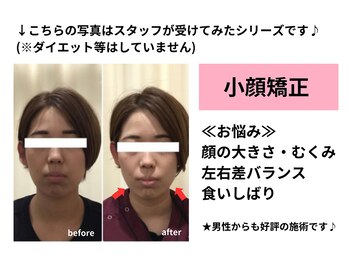 骨盤スタイル鍼灸整骨院 鹿島田院/小顔矯正