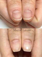 マリーロール 梅田店(Marie Laure)/深爪矯正/自爪育成/自爪風