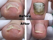 巻き爪補正店 徳重店の雰囲気(巻き爪、陥入爪/変形爪を根本から改善)