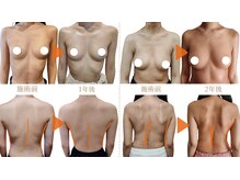 エミュボディ 青山本店(emu body)の雰囲気（他バストサロンと違い、写真加工/ブラ・タオルのバスト寄せなし*）