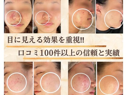 ドクター小顔 銀座店(Dr.小顔)の写真