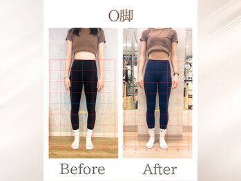 ラ ピラティス 横浜店(La pilates)/O脚改善/姿勢改善