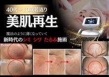 ビューティーワンド ココ(Beauty Wand COCO)
