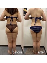 ココ アンジュ(COCO ANGE)/