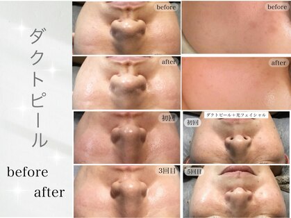 アウラ(AURA)の写真