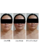 ルル(Ruru)/比較写真/モデリングパック