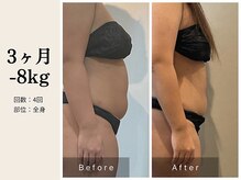 サロン ルイス アディクト(salon Lewis Addict)/脂肪冷却