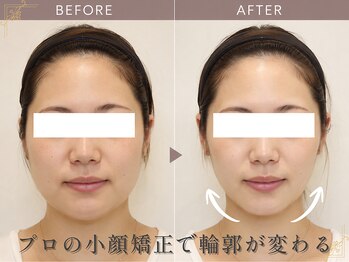 てん整体整骨院の写真/国家資格者による「小顔矯正」がスゴい★お顔の左右差もスッキリ解消【小顔矯正￥4980】リフトアップも◎