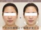てん整体整骨院の写真/国家資格者による「小顔矯正」がスゴい★お顔の左右差もスッキリ解消【小顔矯正￥4980】リフトアップも◎
