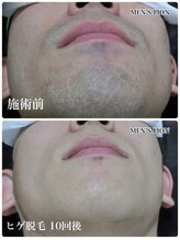 メンズ脱毛サロン ライオン 渋谷(LION)&nbsp;店長 認定脱毛士