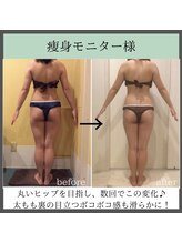 トータルビューティーサロン レビュー(REVIEW)/【Before/After】3MAXビューティ