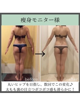 トータルビューティーサロン レビュー(REVIEW)/【Before/After】3MAXビューティ