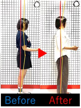 池袋東鍼灸整骨院/姿勢写真