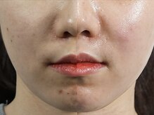 クリアー(CLEAR.)/【Before＆After】