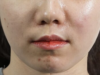 クリアー(CLEAR.)/【Before＆After】