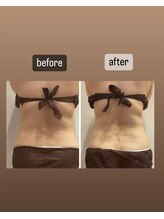 ララ(LALA)/痩身デトックスリンパマッサージ