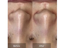 ビュップ 鶴ヶ峰店(美up)/ララピール