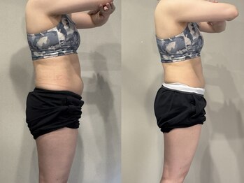 エルディジムズ サッポロ(LD GYM’s sapporo)/お客様のビフォアフターです♪