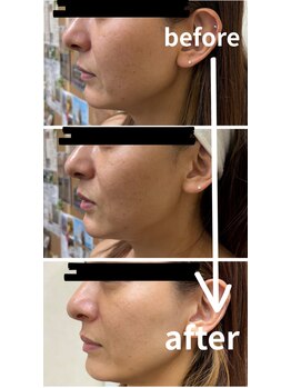 クレビア(Crebia)/バイオセルショット65モニター様