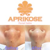 アプリコーゼ(APRIKOSE)