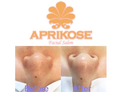 アプリコーゼ(APRIKOSE)の写真