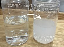 ミランオオサカ(MIRAN OSAKA)/毛穴洗浄