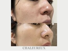 サロン ド ボーテ シャルル(Chaleureux)/